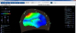 Preview: Atlantis I 4-Kanal EEG-Neurofeedback-Gerät