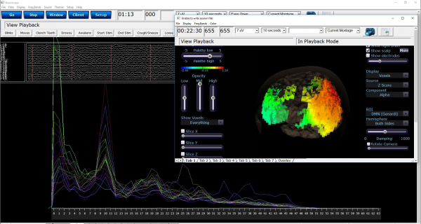 Discovery 24E EEG-Gerät 19 Kanal mit BrainAvatar Acquisition (ohne integrierten Impedanzmesser)