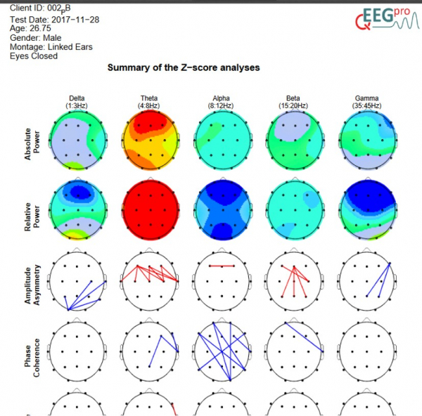 qEEG-Pro Report Service 90 Day Trial