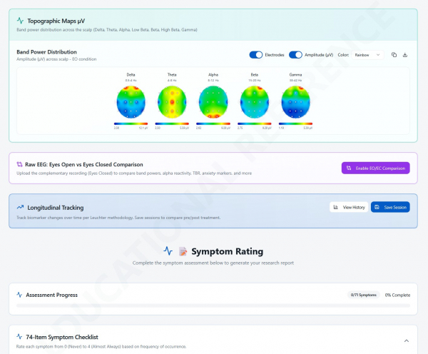 Neuropathfinder wissenschaftliche QEEG-Analyse Beta-Version - nur für Beta-Tester