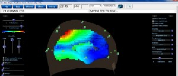 Atlantis 4-channel EEG-Neurofeedback Device